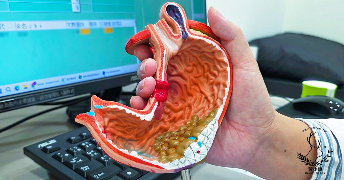 【台北胃肉毒減重推薦】腸胃科減重專家何承祐醫師